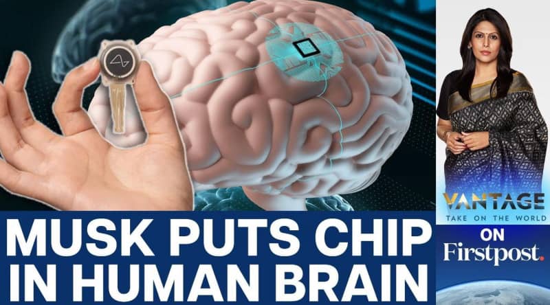 埃隆-马斯克的“神经链路”公司为人类植入首个大脑芯片！